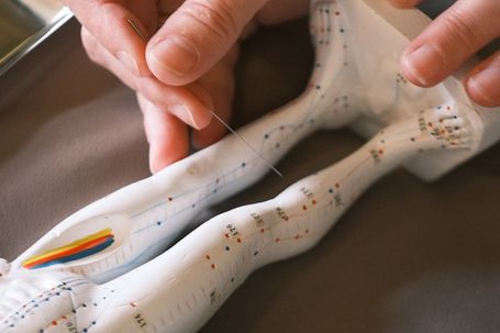 Dry Needling, Berlin Moabit, HP Brunner, Naturheilpraxis Daniel Brunner