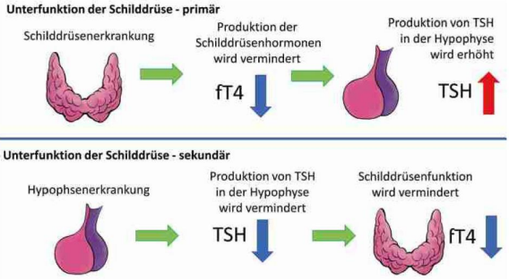 Hypothyreose, Naturheilpraxis Daniel Brunner Berlin, HP Brunner